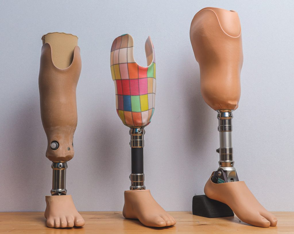 Our prosthetics workshop