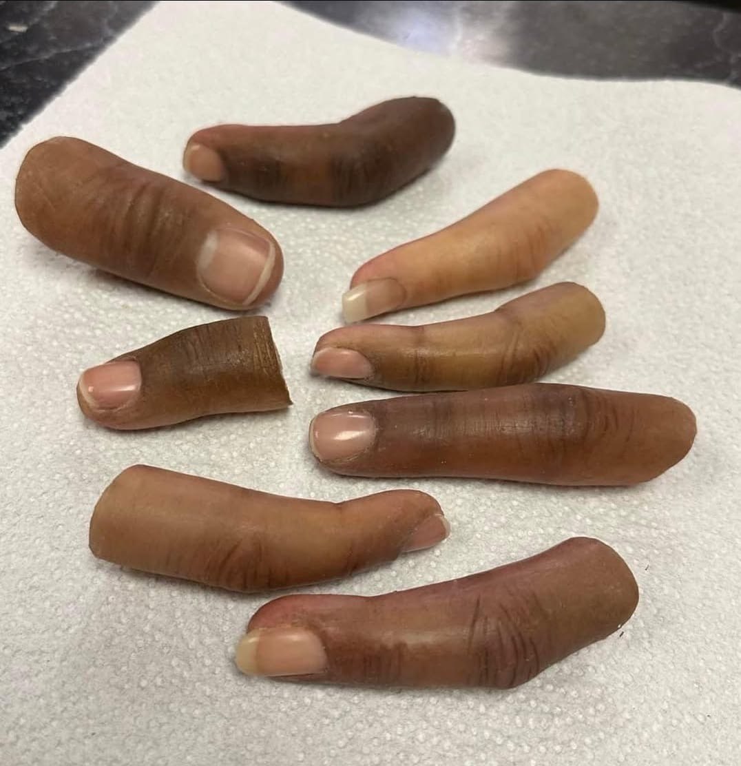 Finger Prosthetic